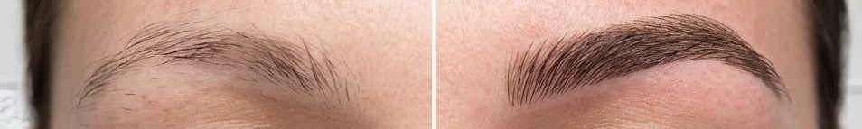 Before After
